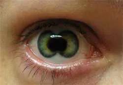 人类5种罕见的瞳孔颜色（人类5种罕见的瞳孔图片）